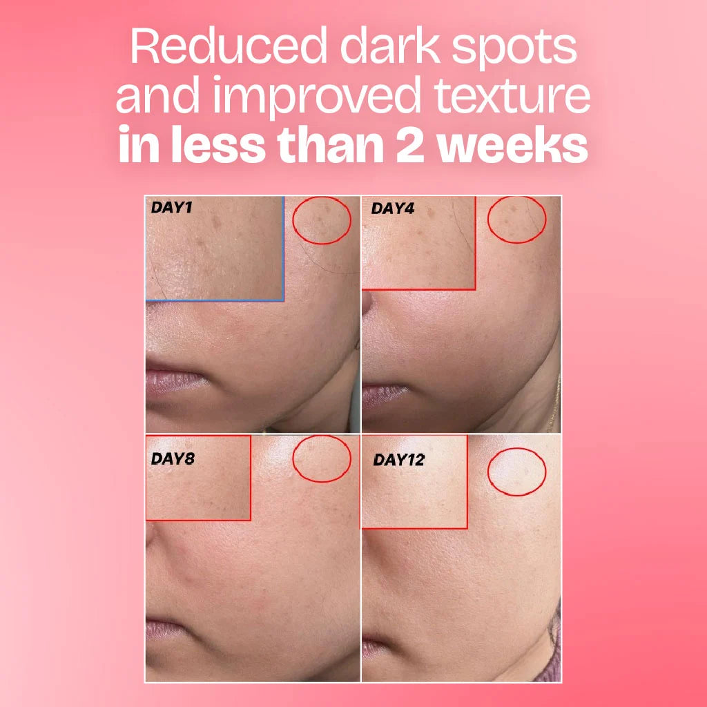 Glow Combo- Serum and Moisturizer